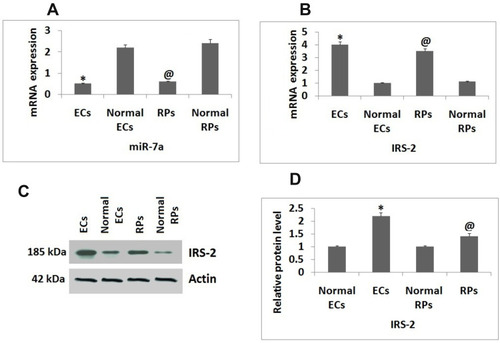 Figure 1 Expression of miR-7a and IRS-2 in Endothelial cells and Retinal Pericytes. (A) qRT-PCR analysis for expression levels of miR-7a in Endothelial cells and Retinal Pericytes against normal controls. (B) Results of qRT-PCR for expression of mRNA levels of IRS-2 in Endothelial cells and Retinal Pericytes against normal controls. (C) Western blot assay for protein levels of IRS-2 Endothelial cells and Retinal Pericytes. (D) Relative protein levels against Actin as loading control. The results are presented as the mean ± standard deviation (n=3). *P<0.05 compared to normal Endothelial cells; @P<0.05 against normal Retinal pericytes.