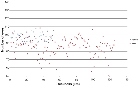 Figure 6 Distribution of GCC superior thickness values for patients in normal group and PPG group.Abbreviations: GCC, ganglion cell complex; PPG, preperimetric glaucoma.