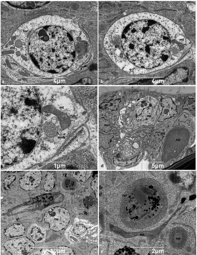 Figure 6. Ultrastructural features of neuronal and epithelial cells. (A-B) Sections of the neuron showing the rounded and central nucleus, mitochondria, Golgi and sparse rough endoplasmic reticulum; (C) detail of perikaryon shown in B illustrating a multivesicular body near a mitochondrion; (D-E) epithelial cells with irregularly shaped nucleus (note the abundance of mitochondria and the highly developed rough endoplasmic reticulum appearing as whorls); (F) close up of an elongated mitochondrion, and rough endoplasmic reticulum. go - Golgi, mt- mitochondrion, mvb- multivesicular body, nu - nucleus, rer - rough endoplasmic reticulum.