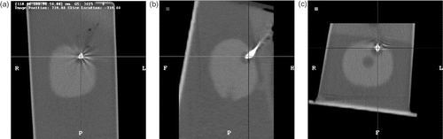 Figure 4. CT image example showing needle tip in tumor. (a) XY section. (b) ZY section. (c) XZ section. [Color version available online.]