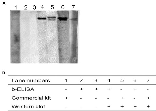 Figure 10 Evaluation of the discrepancy of testing results between sdAb-ELISA and the commercial ELISA kit by Western blot.Notes: (A) Western blot was performed to detect swine serum samples with discrepancy between sdAb-ELISA and the commercial ELISA kit. (B) The detection results of three indicated methods.Abbreviation: sdAb, single-domain antibody.