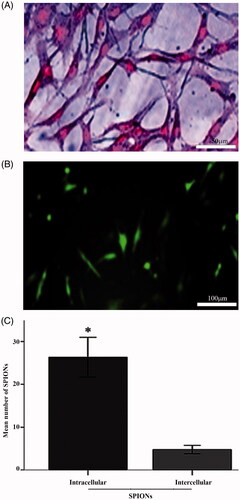 Figure 4. Prussian blue staining. A, NSCs labeled with SPIONs and stained with Prussian blue staining (scale bar = 50 μm). Intracytoplasmic blue dots indicate the presence of intracellular SPIONs. B, Immunofluorescent detection of green fluorescence protein expression using SPIONs-PLL as a nonviral transfection method (scale bar = 100 μm). C, Histogram of the mean number of SPIONs particles located at intracellular and intercellular spaces). *is significantly higher than the other experimental groups (p < .05).