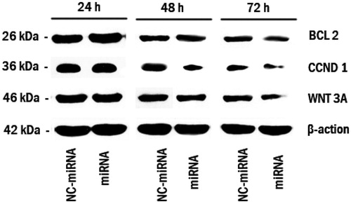 Figure 4. Bcl-2, Cyclin D1 and Wnt3a knocks down following miRNA/ATE–APT complexes delivery to LNCaP cells. Cells were treated with miRNA/ATE–APT (miRNA) and NC-miRNA/ATE–APT (NC-miRNA) complexes and processed for immunoblotting with anti-Bcl-2, anti-Cyclin D1 and anti-Wnt3a antibodies at 24, 48 and 72 h post-transfection. β-actin was a loading control. APT, aptamer; ATE, atelocollagen; and NC, negative control.