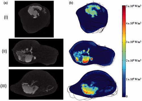 Figure 11. (a) Nanoparticle distribution from micro-CT imaging system and (b) the corresponding qMNH distribution in COMSOL in the axial (I), sagittal (II), and coronal (III) plane, respectively.