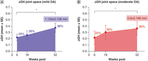Figure 4. Plot of glenohumoral joint space measurements recorded as normalized changes from baseline values for mild (A) and moderate (B) osteoarthritis shoulder cases.Approximate mean percent increases in joint space are overlaid for clarity as well as mean joint space increases (mean ± SE mm) for the 52 week follow-up. Statistically significant increases in glenohumeral joint spacing following micro-fragmented adipose tissue (MFat™) therapy up to 1 year post therapy are indicated in both graphs.*p < 0.05.GH: Glenohumeral; OA: Osteoarthritis; SE: Standard error.
