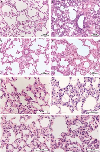 Figure 1 Morphological changes in the lung of female and male Wistar rats on the first day after LPS injection of one of two doses: 1.5 or 15 mg/kg.Notes: Hematoxylin and eosin staining. (A) Female, 1.5 mg/kg LPS – intra-alveolar edema, enlarged perivascular lymphatic fissure, original magnification: 200×. (B) Male, 1.5 mg/kg LPS – pronounced intra-alveolar edema, foci with acute emphysema, original magnification: 200×. (C) Female, 15 mg/kg LPS – foci of intra-alveolar edema, bronchial lumen filled with eosinophilic masses, enlarged perivascular lymphatic fissures, original magnification: 200×. (D) Male, 15 mg/kg LPS – pronounced and widespread intra-alveolar edema, original magnification: 200×. (E) Female, 1.5 mg/kg LPS – thickened inter-alveolar septa with neutrophils, original magnification: 640×. (F) Male, 1.5 mg/kg LPS – neutrophil infiltration in inter-alveolar septa, original magnification: 640×. (G) Female, 15 mg/kg LPS – high number of neutrophils in inter-alveolar septa, edema, original magnification: 640×. (H) Male, 15 mg/kg LPS – pronounced neutrophil infiltration in inter-alveolar septa, original magnification: 640×.Abbreviation: LPS, lipopolysaccharide.