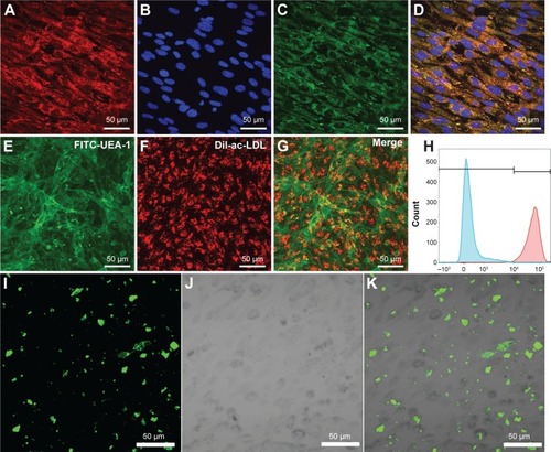 Figure 2 Confocal images and flow cytometric analysis of ECs.Notes: vWF (A), nucleus (B), and CD31 (C) of ECs were stained and then merged (D). UEA-I on endothelial cell membrane (E) and ingested LDL (F) were shown and then merged (G). The purity of the harvested ECs was determined by staining with PE-conjugated antihuman CD31 antibody to be 98.8% (H). FITC-conjugated DATS-MSNs (I) were located in ECs (J) indicated by the green fluorescence in cytoplasm (K).Abbreviations: DATS-MSNs, diallyl trisulfide-loaded mesoporous silica nanoparticles; ECs, endothelial cells; PE, phycoerythrin; LDL, low density lipoprotein; FITC, fluorescein isothiocyanate.