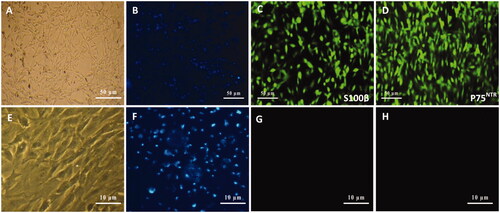Figure 2. Schwann cells (SCs) isolated from sciatic nerve of neonatal rats using DMEM/D valine medium (A). SCs were visualized by nuclei staining with Hoechst (B), and characterized by immunocytochemistry using S100β (C) and p75NTR (D) monoclonal antibodies which were immunoreactive for markers. Similar to SCs, fibroblast cells as a negative control (E) were also visualized by nuclei staining (F) and characterized with S100β (G) and p75NTR (H) antibodies which were non-immunoreactive for these markers.