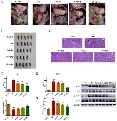 Figure 5. Compound 51 suppressed LPS-induced inflammatory response in vivo. (A-B) The picture of mice organs. (C) HE staining of spleen tissues. Scan bar:50 μM. (D-E) The levels of IL-6 and TNF-α in blood. The samples were analysed by ELISA kits. (F–G) The SOD and MDA activity in blood. ###p < 0.001 compared with control group. *p < 0.1, **p < 0.01, ***p < 0.001 compared to LPS group. (H) The expression of NF-κB in splenic organ. The samples were analysed by WB.