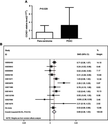 Figure 7 The expression of CCND1 in PDAC. (A) CCND1 expression in FFPE PDAC tissues and para-carcinoma tissues. (B) Forest plot for the miR-193a-3p expression in PDAC.Abbreviation: FFPE, formalin-fixed paraffin-embedded.