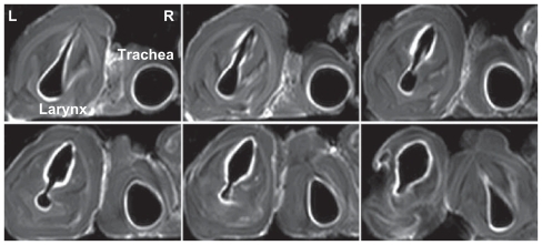 Figure 5 Transverse magnetic resonance images of ex vivo pig laryngeal and tracheal lumen in successive scanning layers after nebulization delivery of the lipid-stabilized contrast agent. In each image, the left is the larynx, and the right is the tracheal lumen.