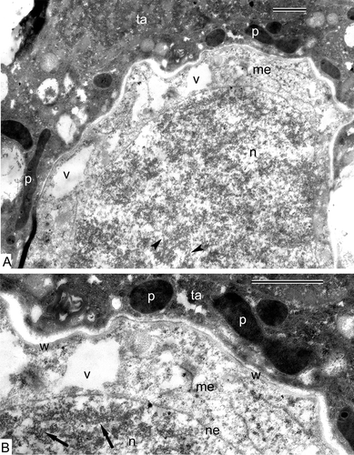 Figure 3. Prophase I of meiosis in Alsophila setosa. A. The beginning of the prophase (leptotene stage): The axial elements of the chromosomes start to be visible (arrowheads); the cytoplasm of the meiocytes contains many autolytic vacuoles, elimination of ribosomes and dedifferentiation of plastids take place; the tapetal cells are dark-contrasted and have plastids of ribbon-like and oval form, which are especially osmiophilic. B. Magnified part of (A): Tapetal cells have so-called negative contrast: membranes appear white, but stroma of plastids and the cytoplasm are strongly osmiophilic; the wall of meiocytes is wavy; axial elements of chromosomes visible (arrows). Abbreviations: see Figure 1. Scale bars – 1 μm.