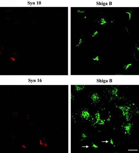 Figure 6. Knockdown of syntaxin 10 expressions has no effect on Shiga B transport to the TGN. Cells were transiently transfected with syntaxin 10 (Syn10) or syntaxin 16 (Syn 16) siRNA oligomers for 48 h. Cells were then incubated with Shiga B fragment (5 µg/ml) for 1 h and then fixed with 4% paraformaldehyde. They were incubated with primary antibody against syntaxins 10 or 16 (rabbit) and mouse monoclonal antibody against Shiga B, followed by Texas-red or FITC-labeled secondary antibodies. In cells with efficient syntaxin 16 knockdown, Shiga B staining remained spotty and early-endosome-like. Arrows indicated cells where syntaxin 16 knockdown was not particularly effective, and syntaxin 16 staining is still visible in these cells. Note that Shiga B transport to the perinuclear TGN patch was not impaired in these cells. Bar = 10 µm. This figure is reproduced in colour in Molecular Membrane Biology online.