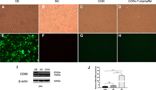 Figure 1 CD86-EGFP expression in THP-1 cells via lentivirus. (A) CD86-EGFP-THP-1 cells of the OE group, (B) NC-THP-1 cells of the NC group, (C) THP-1 cells of the CON group and (D) co-culture of T. marneffei with macrophages of the CON group (the white arrows showed T. marneffei conidia) were observed under light microscopy. (E) The CD86-EGFP with green fluorescence appeared in the OE group, but no green fluorescence appeared in (F) the NC group, (G) the CON group and (H) the macrophages of the CON group after T. marneffei infection. (I) The specific CD86 protein bands of the NC and CON groups appeared at 70 kDa, and the specific protein bands of the OE group appeared at 70 kDa and 97 kDa. The band of EGFP was approximately 27 kDa, so the band at 97 kDa represented fusion protein CD86-EGFP. (J) The CD86 expression was significantly increased in the OE group in comparison with the NC group and CON group, respectively, by qRT-PCR analysis (****P < 0.0001, ns P > 0.05) (original magnification: ×400).
