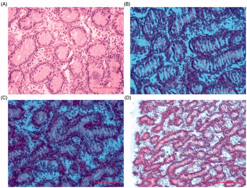 Figure 2. Photomicrographs of chick testis (HE staining). (A) The normal architecture of testis tissue in the control group (400×). (B, C) Testis tissue was injured in the Low Se group (400×). (D) Testis tissue was injured in the low Se group (200×).