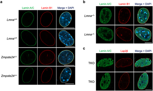 Figure 2. Nuclear lamin distribution in mouse embryonic fibroblasts (MEFs), as judged by immunofluorescence microscopy. Fixed and permeabilized MEFs were stained with lamin A/C- and lamin B1-specific antibodies, and confocal images across the middle of the nucleus (in the z-plane) were recorded. In Lmna+/+ and Zmpste24–/– MEFs (a), the nuclear lamins were located along the nuclear rim. In Lmna–/– MEFs (b), the truncated lamin A was predominantly nucleoplasmic but with detectable enrichment along the nuclear rim. In Lmna–/–Lmnb1–/–Lmnb2–/– (TKO) MEFs (c), the truncated lamin A was entirely nucleoplasmic. Scale bars, 10 µm.