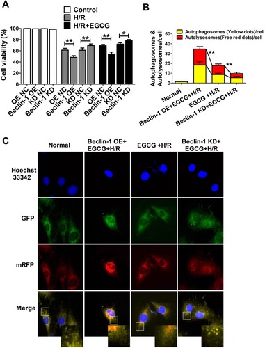 Figure 8 EGCG attenuated H/R-induced H9c2 autophagy by down-regulating Beclin-1.