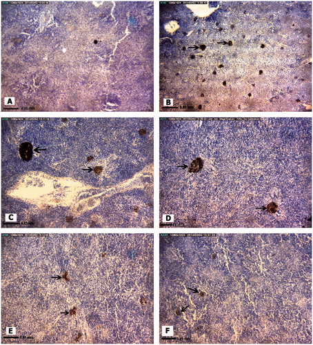 Figure 2. Representative photomicrographs of A. latus spleen tissue structures. (A) Control site with normal Red pulp and white pulp. (B) Petrochemical Station: Significant increase in melano-macrophage aggregations (black arrow). (C) Gaafari station, (D) Majidieh Station, (E) Ghazaleh Station and (F) Zangi Station: Melano-macrophage aggregations (black arrows). All samples; H&E-stained, magnification = ×725).