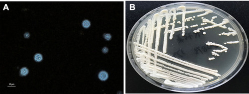 Figure 1 (A) Morphology of C. neoformans in blood culture bottle by Indian ink staining (×400). (B) Colony morphology of C. neoformans on Sabouraud dextrose agar.