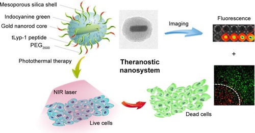 Figure 1 A schematic illustration to show the formation of I-TMSG complex, as well as its theranostic application to photothermal therapy treatment and near-infrared fluorescence imaging.Abbreviations: I-TMSG, tLyp-1 peptide-functionalized, indocyanine green-containing mesoporous silica-coated gold nanorods; PEG3500, polyethylene glycol-3500; NIR, near-infrared.