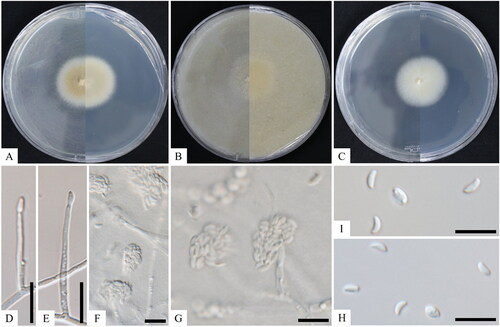 Figure 1. Cultural and morphological characteristics of KNUF-20-047T. The colony growth on potato dextrose agar (A), oatmeal agar (B), and malt extract agar (C) after 14 days of incubation at 25 °C. Lateral phialidic pegs (D, E); conidiophores arising laterally from somatic hyphae (F, G); conidia (H, I). Scale bars: D–I = 10 μm.