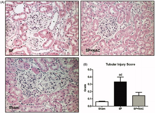 Figure 4. N-acetylcysteine (NAC) ameliorates renal histological lesion. (A) Histopathology of renal cortex: representative photomicrographs of kidney tissue samples. Magnification, ×400. (B) Bar graph of tubular injury scores. SF (Star fruit group), SF + NAC: star fruit + NAC therapy, Sham: control group. Data are mean ± SEM; ap < .001, bp < .01 vs. Sham; cp < .001, dp < .01 vs. SF + NAC. *flattening and dilatation of renal tubule.