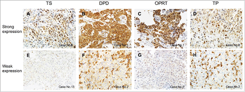 Figure 1. Examples of immunohistochemical staining of MPM.