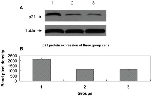 Figure 5 p21 protein expression for cells from three groups. Western blotting of equal amounts of cell lysates probed with the monoclonal antibody directed against the human p21 protein. (A) There was a marked upregulation of p21 in the pcDNA3.1-DCN group as compared with the control group and the empty vector group. Lane 1, lane 2, and lane 3, respectively, show p21 expression for the pcDNA3.1-DCN, control, and empty vector groups. The results are representative of three repeated experiments. (B) Densitometric analysis was done using Lab image software.