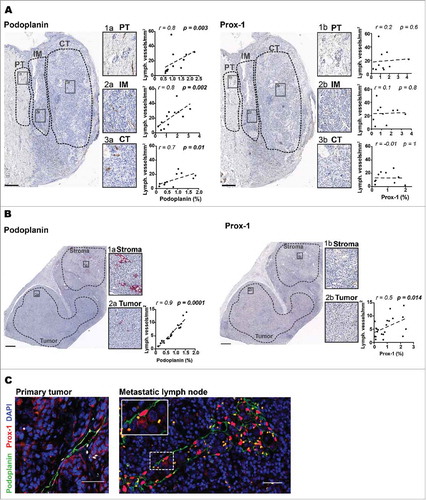Figure 1. Comparison of lymph vessel density (LVD) assessment by automated pixel based large-scale quantification versus LEC counting by eye. Representative immunohistochemistry images showing podoplanin and Prox-1 staining of peritumoral area (PT), invasive margin (IM) and center of tumor (CT) of A) primary melanoma and B) stroma and tumor regions of metastatic lymph node sections (Scale bars in A) 500 µm; in B) 1mm). Correlations of podoplanin or Prox-1 (% of pixel positive cells) counted by the ImageScope™ software (x-axis) versus counted by eye (y-axis) in IM (n = 12), CT (n = 11) and PT (n = 12) of primary tumors and in tumor regions of metastatic LNs (n = 22). C) Representative immunofluorescence images of podoplanin (green) and Prox-1 (red) co-localization in different tissues (20X, scale bar = 50 μm, DAPI, blue). All correlations were analyzed using non-parametric Spearman's test. (PT): peritumoral area, (IM): invasive margin, (CT): center of tumor.