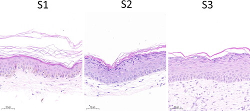 Figure 2. Histopathological observation of the skin. S1, primary skin; S2, secondary skin; S3, tertiary skin; Red arrows indicate melanocytes. Scale bars, 50 μm.