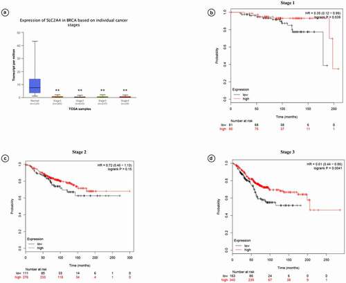 Figure 5. Prognostic values of SLC2A4 in breast cancer patients with different cancer grades