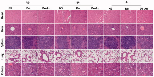 Figure 10. H&E staining photos of heart, liver, spleen, lung, and kidney in every treatment groups.