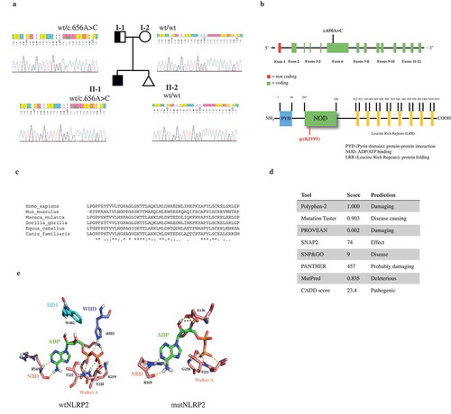 Figure 2. In silico analysis of the NLRP2 mutation. (a) Pedigree of the index case identified as heterozygous for a novel c.656A> C mutation in the NLRP2 gene, as shown in electropherograms. The observed mutation was inherited from the father. (b) Schematic representation of the NLRP2 gene and its encoded protein, indicating the position of the identified mutation. (c) Phylogenetic conservation of the amino acid affected by the observed mutation. (d) In silico pathogenic prediction. (e) wt- and mutNLRP2 modelling. In wtNLRP2 ADP is bound to the NBD1 subdomain of NOD: R169 atoms form hydrogen bonds with the N1 and N6 atoms of the adenine base, the T221 atoms form three hydrogen bonds with the α-phosphate group of ADP and the T220 G216 and K219 atoms form three hydrogen bonds with the b-phosphate groups of ADP. ADP also binds to the WHD subdomain of NOD by forming three hydrogen bonds between the H503 residue and the α-phosphate group. In mutNLRP2, ADP makes hydrogen bonds only with residues of the NBD1 subdomain: R169 atoms form hydrogen bonds with the N1 and N6 atoms of the adenine base, the G218, T221 and T220 atoms form four hydrogen bonds with the α-phosphate group, while the E136 atoms make four hydrogen bonds with the ribose hydroxyl groups.Symbols: * (asterisk) indicates a fully conserved residue; colon (:) indicates conservation between groups of strongly similar amino acids; dot (.) indicates conservation between groups of weakly similar amino acids.