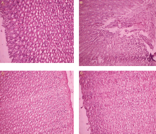 Figure 5.  Histopathological studies of prodrugs. (A) Healthy control. (B) Ulcer control showing mucosal injury induced by MA and massive mucosal infiltration of inflammatory cells. (C) Treated with MAT. (D) Treated with MAG.