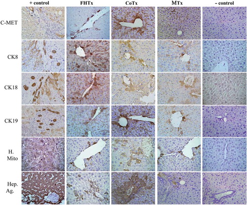 Figure 5. Transplantation of hFH and hFLMSC in nude mice. Paraffin-embedded sections were stained for human c-Met, CK8, CK18, CK19, mitochondrial antigen and hepatocyte antigen. Engrafted human cells stained dark brown. Biopsy sections from patients with liver cancer served as a positive control and a sham group as a negative control. HE counterstained. Magnification 40 ×. Paraffin-embedded sections were stained for human-specific AFP nuclear antigen. Biopsy of liver cancer served as a positive control and a sham group as a negative control. HE counterstained. Magnification 40 ×.