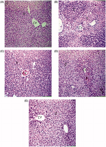 Figure 3. Hematoxilin- and eosin-stained sections showing the effect of artichoke leaf extract (ALE) on histological liver changes induced by paracetamol. Original magnification, ×40. (A) Group I: treated with vehicle; (B) group II: treated with saline + 10% Tween 80 orally for 14 d followed by paracetamol (2 g/kg, orally); (C) group III: treated with 1.5 g/kg of ALE orally for 14 d; (D) group IV: treated with 1.5 g/kg of ALE orally for 14 d followed by paracetamol (2 g/kg, orally); (E) group V: treated with 100 mg/kg of N-acetylcysteine (NAC) orally for 14 d followed by paracetamol (2 g/kg, orally). cv, central vein; h, hepatocytes; d, degeneration; n, necrosis; s, sinusoids.