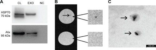 Figure 3 Characterization and visualization of exosomes-USPIO.Notes: (A) Western blot analysis of the expression of HSP70 (70 kDa) and Alix (95 kDa) in exosomes. Supernatant lacking the ASC and exosomes was used as NC. (B) On the left, MR images of exosomes-USPIO (top) and unlabeled exosomes (bottom) immobilized in gel are shown. The square images on the right show a higher magnification of the areas of interest in each MR image. (C) TEM image of exosomes (arrows) previously visualized by MRI in gel (B) and finally processed for electron microscopy; they are still labeled with nanoparticles (scale bar 100 nm).Abbreviations: ASC, adipose stem cell; CL, ASC cell lysate; EXO, exosomes; MR, magnetic resonance; MRI, magnetic resonance imaging; NC, negative control; TEM, transmission electron microscopy; USPIO, ultrasmall superparamagnetic iron oxide nanoparticles.