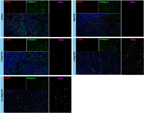 Figure 6 Co-delivery nanomicelles based combination therapy disturbed the function of α-SMA+ CAFs to increase intratumoral infiltration of CD8+ T cells.