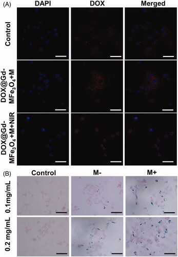 Figure 5. In vitro cellular uptake behavior of DOX@Gd-MFe3O4 NPs: (A) confocal microscopy images of the cellular uptake of DOX@Gd-MFe3O4 NPs (DOX= 5 μg/mL) 4T1 cells, scale bar = 20 μm. (B) Prussian blue staining of 4T1 cells in the presence and absence of magnetic field after 2 h incubation of Gd-MFe3O4 NPs with different concentrations (scale bar = 20 μm).
