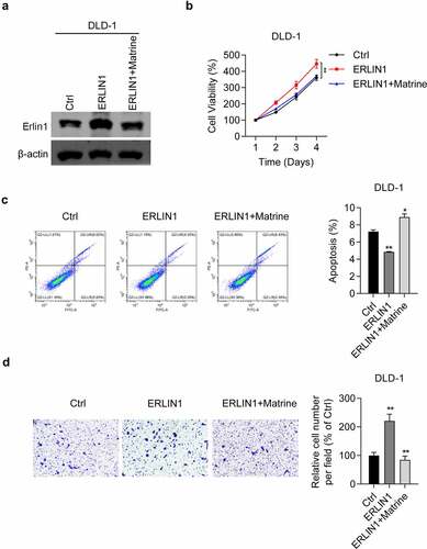 Figure 4. Overexpression of Erlin1 promoted CRC proliferation and migration which can be reduced by matrine.