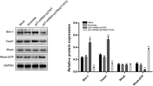 Figure 5. The effect of p27 translocation on the protein levels of Bim-1, Twist1, RhoA, and RhoA-GTP in NPC cells. **p < .01 versus scramble group. All data are presented as mean ± SEM from three independent experiments.