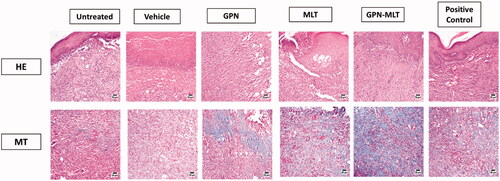 Figure 3. Effects of GPN, MLT, GPN-MLT nanoconjugate and marketed formulation on the histopathological analysis (A) H & E staining and (B) MT staining.