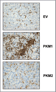 Figure 9 Fibroblasts overexpressing PKM1 promote an inflammatory response in tumor tissue. To evaluate inflammation, frozen sections of the tumor xenograft were analyzed using CD45 antibodies, detecting nucleated hematopoietic cells, including neutrophils and macrophages. Note that CD45 is highly expressed in PKM1-tumors, indicative of a significant increase in the inflammatory response. Original magnification, 40×.