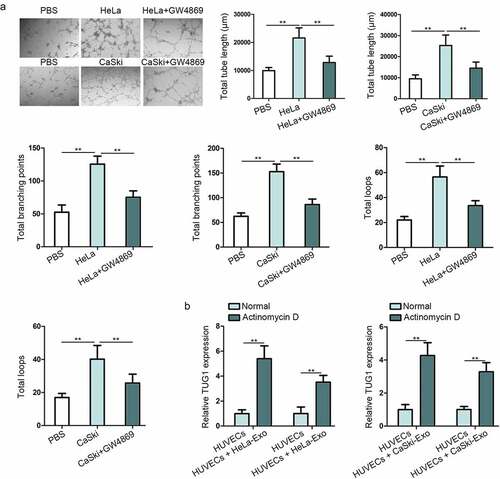 Figure 2. Exosomes derived from CC cells facilitated the angiogenesis of HUVECs and transferred TUG1 to HUVECs. (a). Tube formation assay in HUVECs uncovered the changes of angiogenesis after co-culture with HeLa or CaSki cell line, as well as with GW4869 treatment. (b). The expression of TUG1 was detected by qRT-PCR in HUVECs treated with HeLa-Exo or CaSki-Exo under Actinomycin D supplementation. Data are exhibited as mean ± standard deviation (S.D.; n ≥ 3), **P < .01.