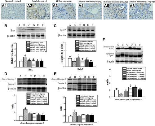 Figure 8 Didymin reduced hepatic apoptosis. (A) TUNEL staining was used to observe the apoptosis levels (400×), A1 to A6 represented the normal, model, 4PBA, and didymin groups (2, 1, and 0.5 mg/kg), respectively; (B–F) The protein expressions of Bax, Bcl-2, Cyt C, cleaved caspase3/caspase3 and cleaved caspase9/caspase9 were detected by Western blotting; bands 1–6 represent the normal group, model control group, 4PBA group, and didymin-treated groups (2, 1, and 0.5 mg/kg), respectively. #P<0.05 VS the normal group and *P<0.05 VS the CCl4 model group.