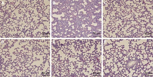 Figure 3 Effects of QBD extract and its compounds in ameliorating LPS-induced histological changes.