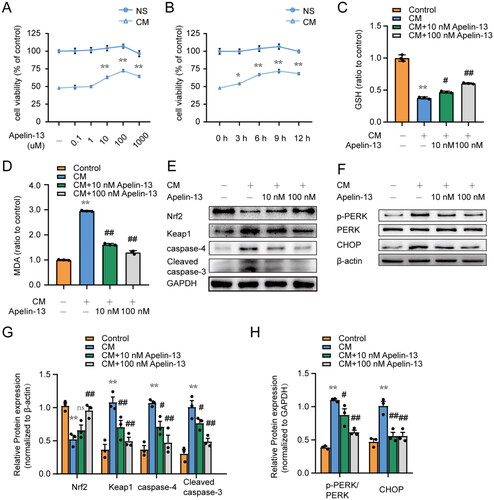 Figure 6. Apelin-13 attenuates iohexol-induced ER stress, oxidative stress and apoptosis in HK-2 cells. (A, B) HK-2 cells were incubated in medium containing 200 mg iodine/mL iohexol and / or interfered with different concentrations of apelin-13 (0, 0.1, 1, 10, 100, 1000 nM) for 6 h. HK-2 cells were incubated in the medium containing 200 mg iodine/mL iohexol for 6 h and / or given the intervention of 100 nM apelin-13 at indicated time points (0 h, 3 h, 6 h, 9 h, 12 h) prior to cell collection. The cells cultured in a normal medium without iohexol were used as a control. Cell viability was detected with CCK-8 assay. Cell viability of the control group was set to 100 %, and other groups were normalized to indicate cell viability changes with the control group (n = 8). (C - H) HK 2 cells were incubated in medium containing 200 mg iodine/mL iohexol and apelin(10 nM, 1000 nM) for 6 h. Cells cultured in the normal medium without iohexol or apelin-13 were used as a control. (C) Cell GSH content. (D) Cell MDA activity. (E - H) Representative bands of p-PERK, CHOP, caspase-4, Cleaved caspase-3, Keap1, Nrf2 and semi-quantitative analysis of these protein expression. *p < 0.05, **p < 0.01, significantly different from control group; #p < 0.05, ##p < 0.01, significantly different from the CM group. Data are expressed as means ± SEMs.