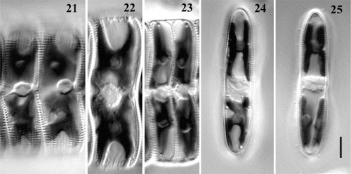 Figs. 21 – 25. Chloroplast and nucleus dynamics during mitotic cycle illustrated by F1-progeny cells of clone C. Figs 21 – 23. Girdle views. Fig. 21. Two interphase cells, with the nucleus appressed to the raphid valve. Fig. 22. Mitosis. Fig. 23. Sibling cells soon after division. Figs 24, 25. Valve view. Fig. 24. Chloroplast (lower) dividing in a pervalvar direction. Fig. 25. Lower chloroplast has divided. Scale bar (for all) represents 10 μm.