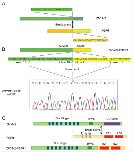 Figure 3. ZMYM2-FGFR1 gene rearrangement, its mRNA transcript, and predicted protein. (A) Diagram showing break points and partial sequences of the 2 participating fusion partner genes. (B) Top diagram shows the fusion of ZMYM2 and FGFR1 genes and the sequence around the break point that were detected by NGS. The DNA sequence in the exon adjacent to the involved intron in each gene is also shown. The fusion transcript was verified by RT-PCR and Sanger sequencing as shown in the bottom chromatogram. (C) Diagrams showing the protein structure of ZMYM2, FGFR1, and their fusion product. (PV)n, proline-valine repeats; DUF3504, domain of unknown function 3504; Ig, Ig-like domains; TK1, TK2, tyrosine kinase domains.