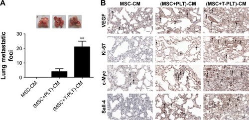 Figure 5 Platelets enhanced the effect of BM-MSCs on tumor progression in vivo.